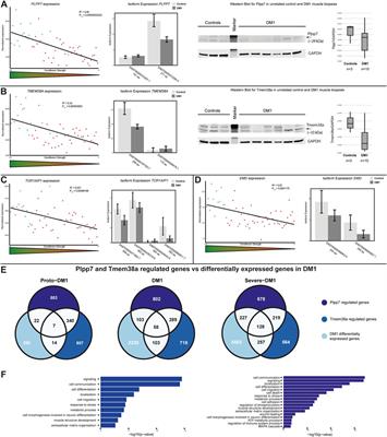 <mark class="highlighted">Nuclear envelope</mark> transmembrane proteins involved in genome organization are misregulated in myotonic dystrophy type 1 muscle